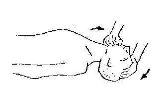 Grafisk illustration af hvordan den forulykkedes hoved kippes så langt bagover som muligt med den ene hånd på hans isse og den anden under hans hage, så munden lukkes