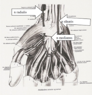 Illustration af de tre hovednerver i undearmen/hånden - n radialis, n ulnaris og n medianus