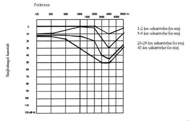 Audiogram over hørenedsættelse renset for aldersforandinger