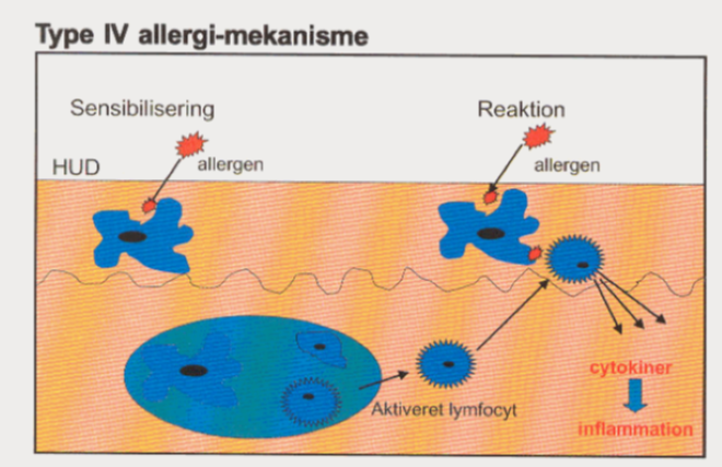 Illustrataion af allergi-mekanismen ved Type IV-allergi med sensibilisering, reaktion, allergen, aktiveret lymfocyt, cytokiner og inflammation